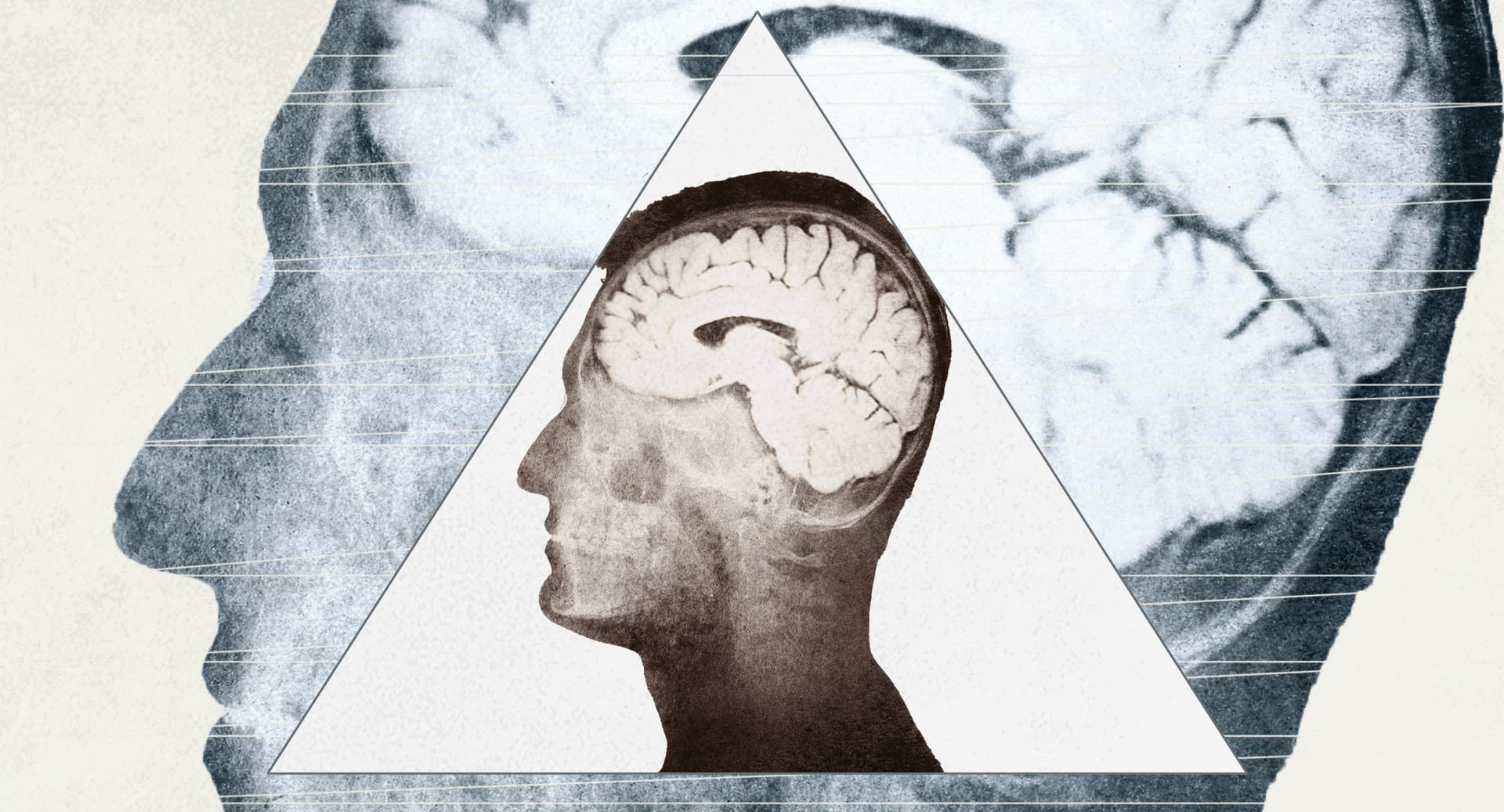 Helping Chronically Depressed Patients Move Forward